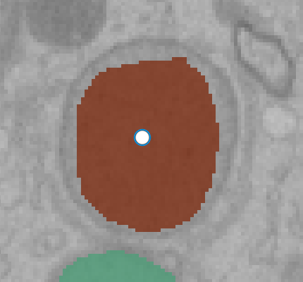 ../_images/morph-dilate-before.png