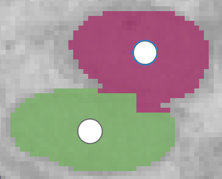 ../_images/morph-erode-before.png